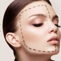 Must-Know Facts About Cleopatra Contour Plastic Surgery